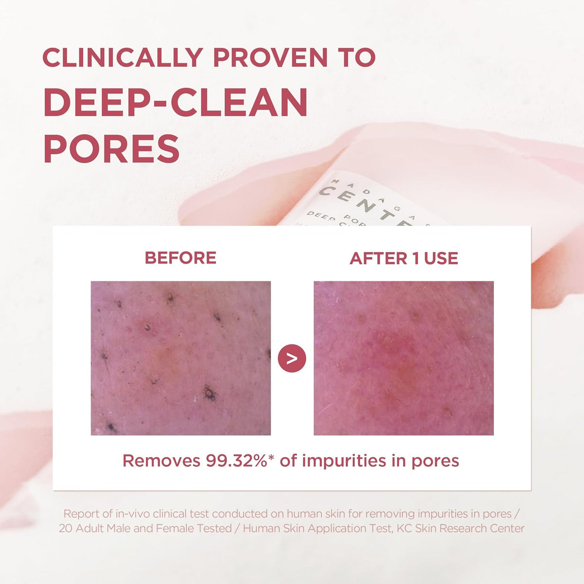 Before and after pore close-ups: clinically proven to deep-clean pores, removing 99.32% of impurities after one use