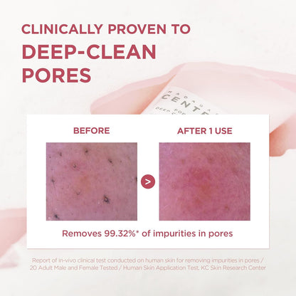Before and after pore close-ups: clinically proven to deep-clean pores, removing 99.32% of impurities after one use