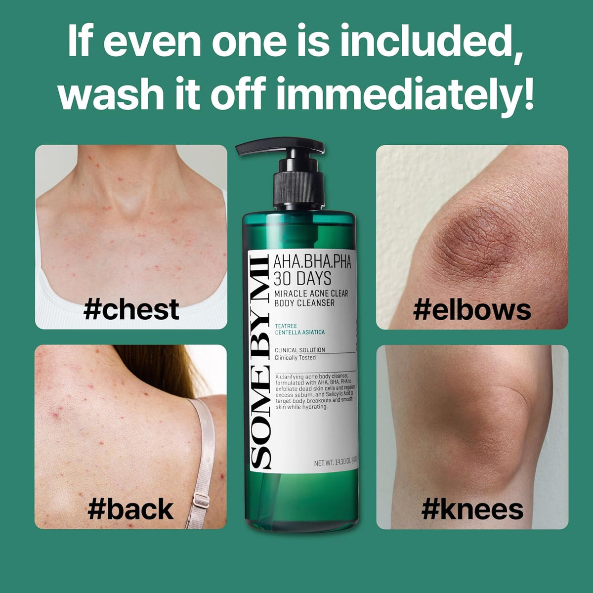 If even one is included, wash it off immediately: photos of blemishes on the chest, elbows, back and knees beside the bottle
