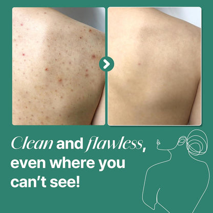 Clean and flawless even where you can't see: before and after photos of a shoulder with blemishes
