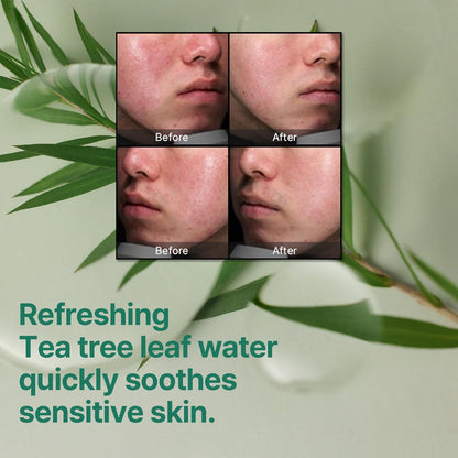 Refreshing tea tree leaf water quickly soothes sensitive skin: four before and after cheek photos on tea tree leaves
