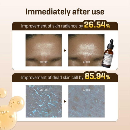 Immediately after use: skin radiance improved 26.54% and dead skin cells improved 85.94%, with before and after forehead and microscope images