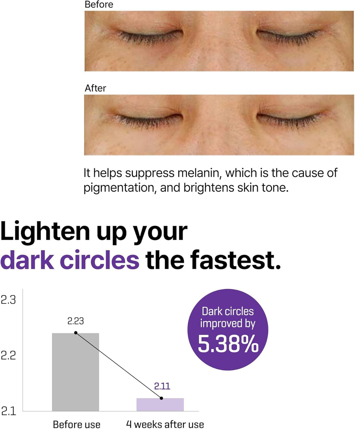 Lighten up your dark circles the fastest: before and after eye photos and a chart showing dark circles improved 5.38% after four weeks
