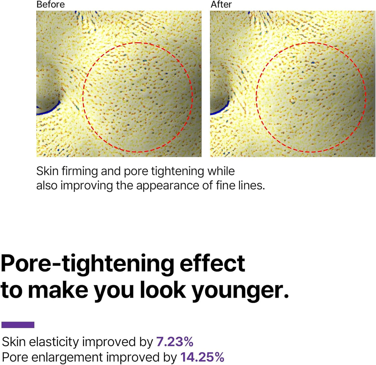 Pore-tightening effect to make you look younger: before and after microscope images, elasticity improved 7.23% and pore enlargement 14.25%