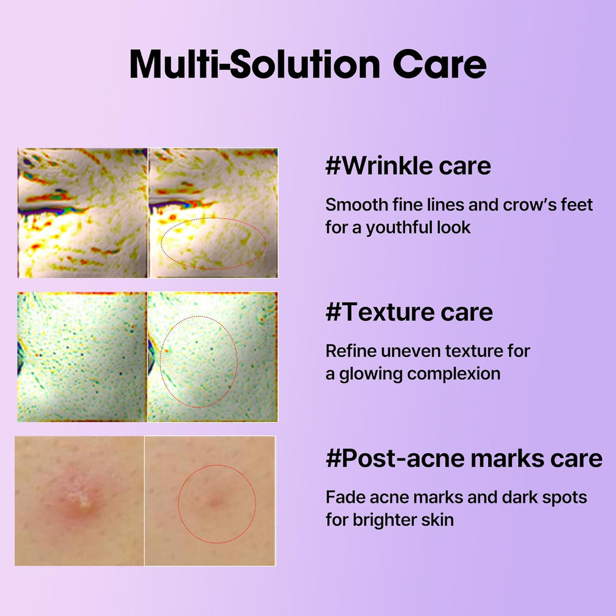 Multi-solution care with before and after images: wrinkle care, texture care and post-acne marks care