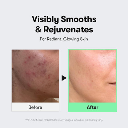 Visibly smooths and rejuvenates: before and after cheek photos from an ambassador review