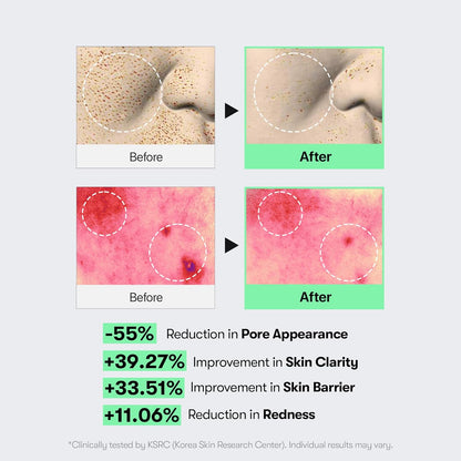Before and after nose and redness close-ups with results: pore appearance down 55%, clarity up 39.27%, barrier up 33.51%, redness down 11.06%