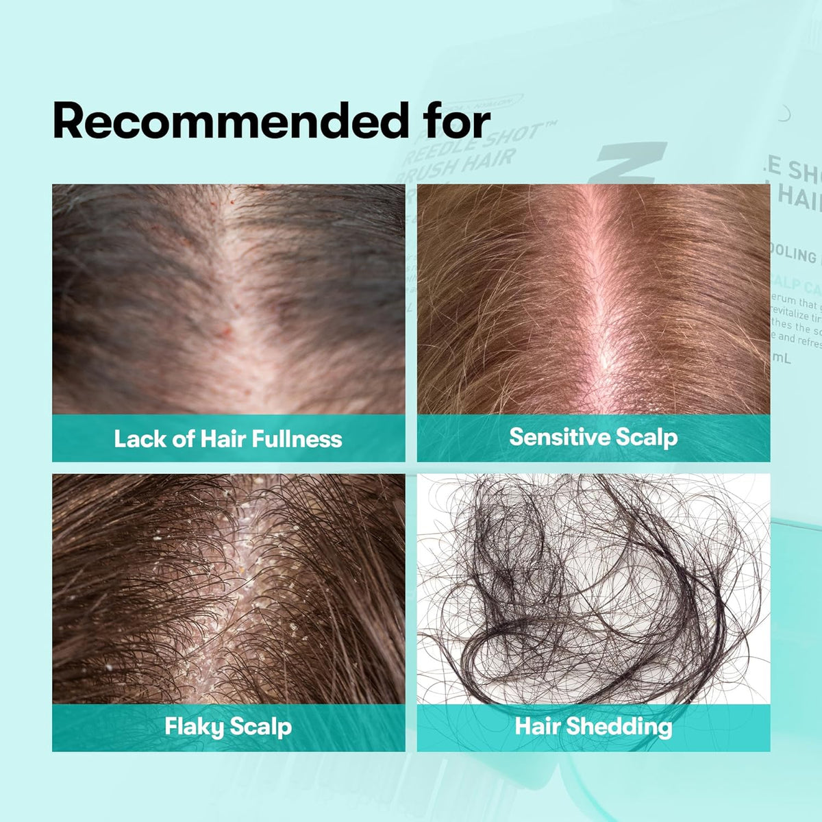 Recommended for: scalp photos showing lack of hair fullness, sensitive scalp, flaky scalp and hair shedding